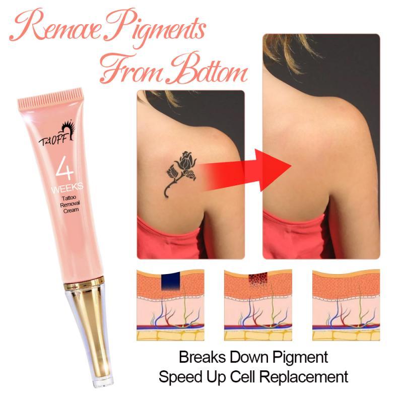 Tattoo removal cream: effective without pain