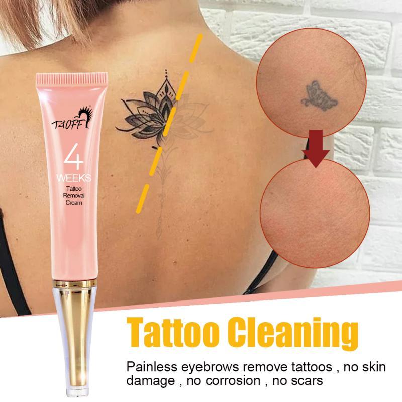 Tattoo removal cream: effective without pain